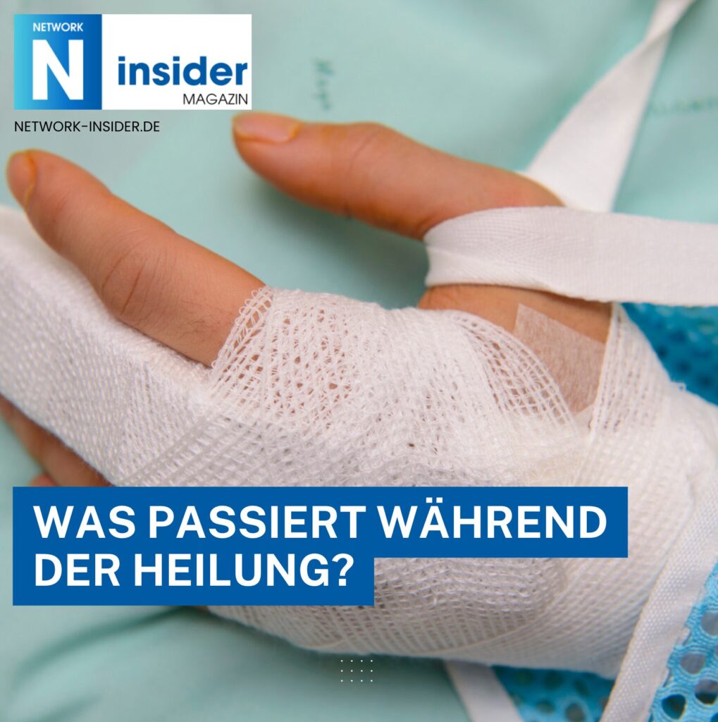 Finger gebrochen wie lange krank? Heilungsdauer und Infos