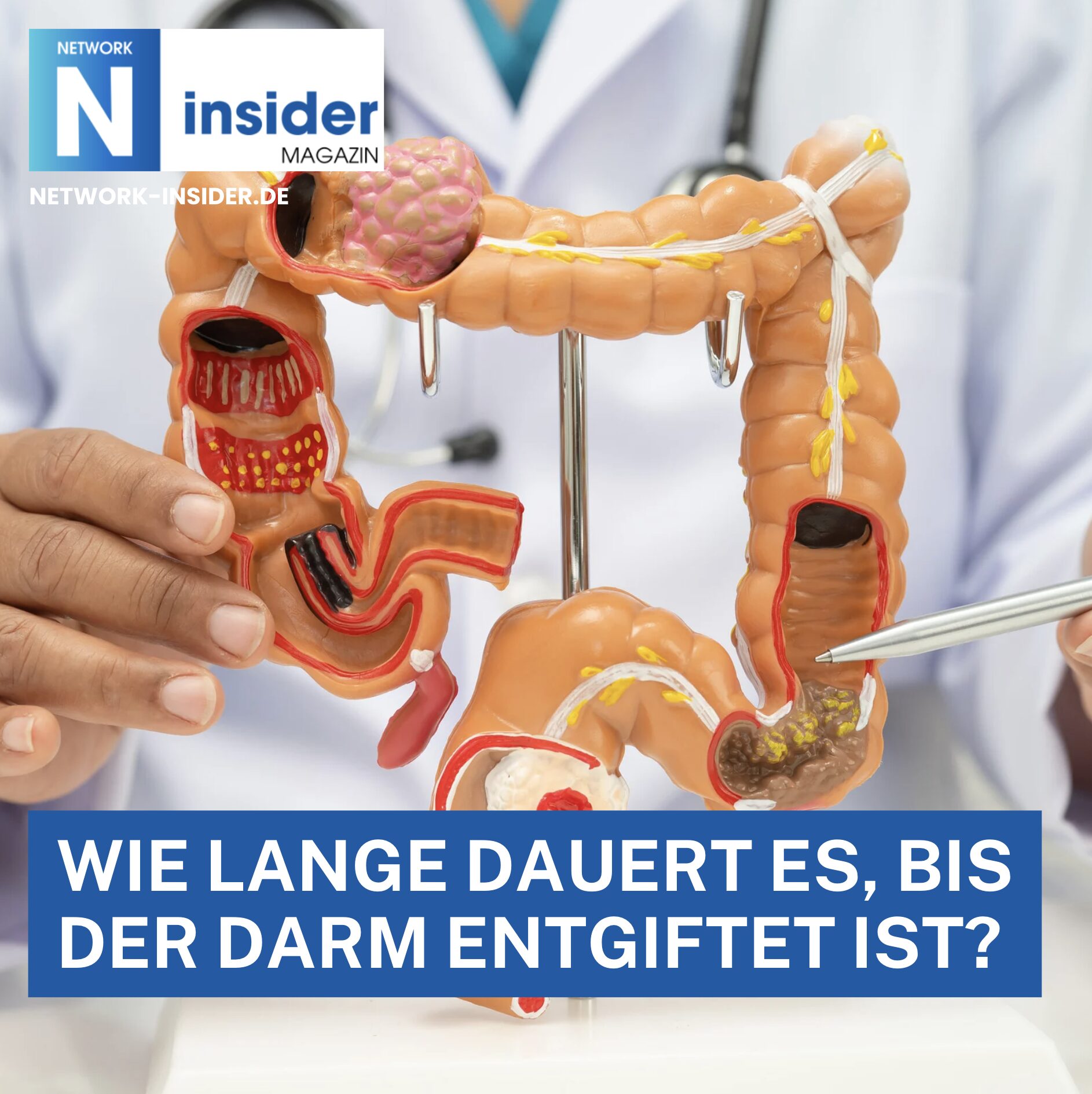 Wie lange dauert es, bis der Darm entgiftet ist? Wie lange dauert es, bis der Darm entgiftet ist?